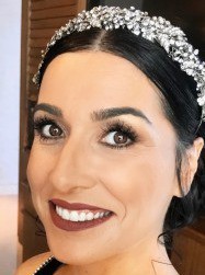Alexandra prev btn