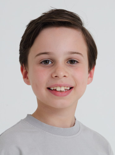 Alexander model in uae  Alexander